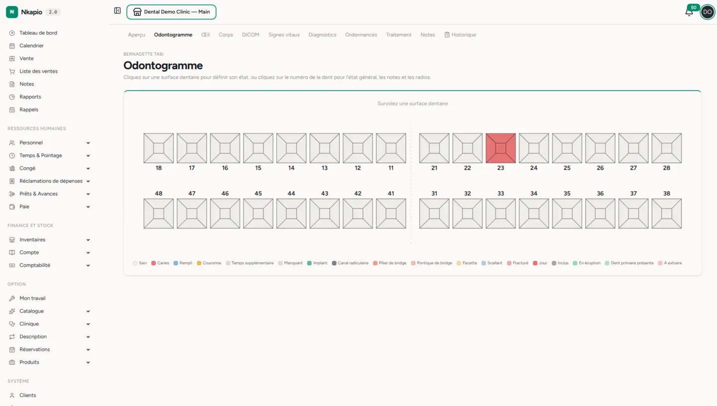 L'odontogramme dentaire